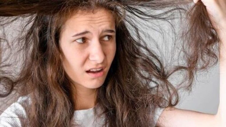 Hair Fall Tips : முடி உதிர்வை தடுக்க நீங்கள் செய்ய வேண்டியது இதுதான்!