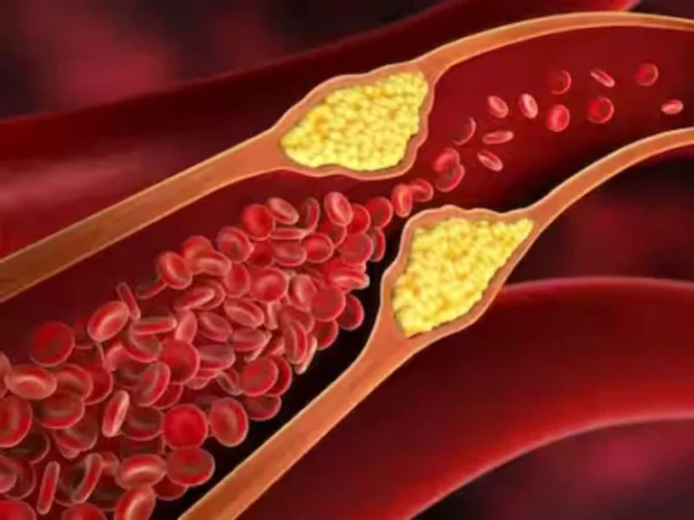 Food for Health: தமனி அடைப்பைத் தடுத்து நரம்புகளில் அழுக்கு சேராமல் பாதுகாக்கும் உணவுகள்