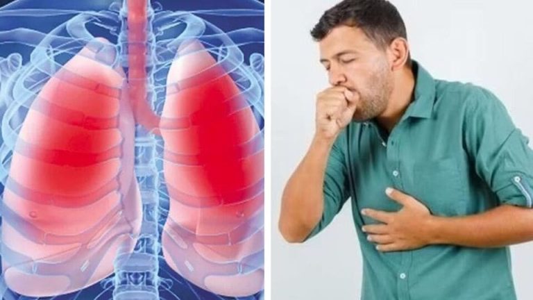 Tuberculosis in India : இந்தியாவும், காசநோய் ஒழிப்பும் – ஓர் அலசல்!