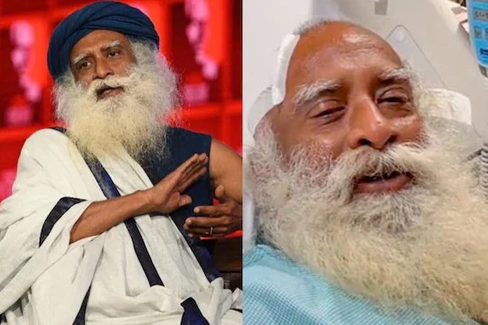 Sadhguru | சத்குருவுக்கு மூளை அறுவை சிகிச்சை செய்ய என்ன காரணம்..? மருத்துவர்கள் விளக்கம்..!